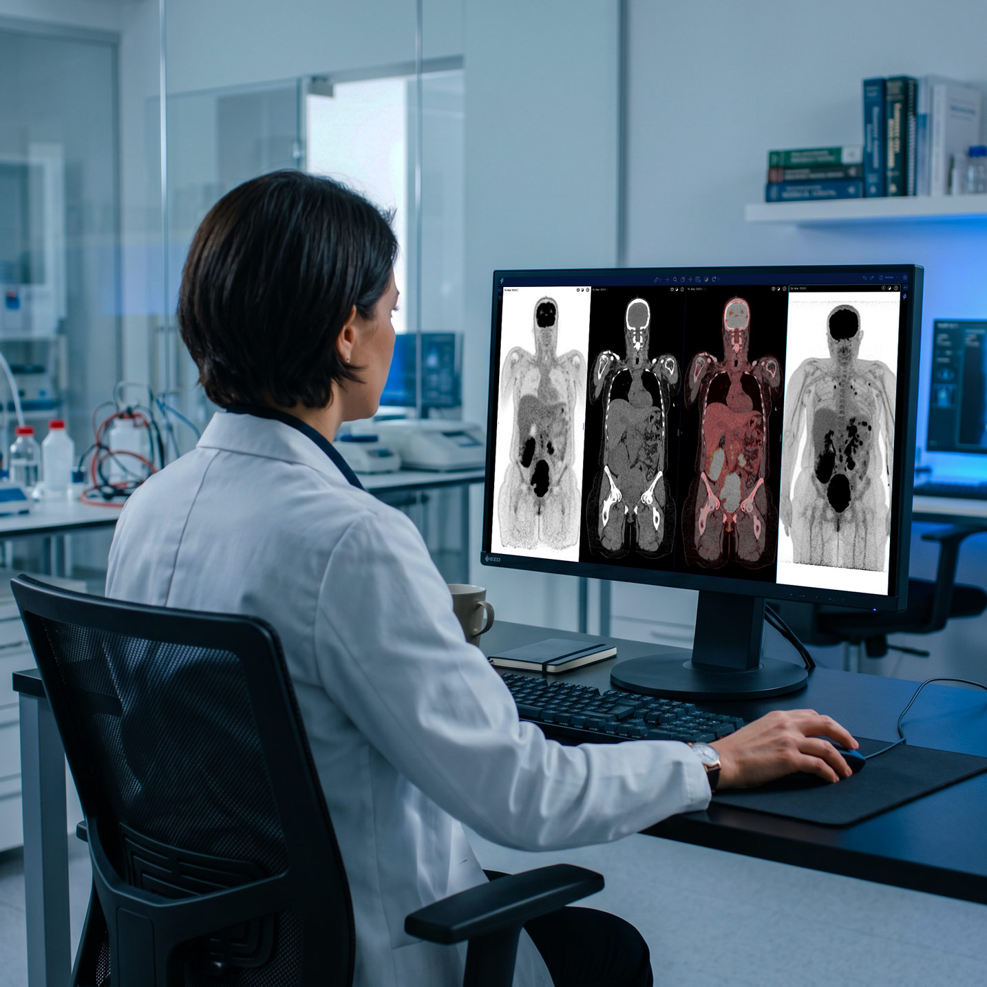 Radiologist reviewing and validating an automated segmentation on a workstation displaying the Pixilib viewer with TMTV results.